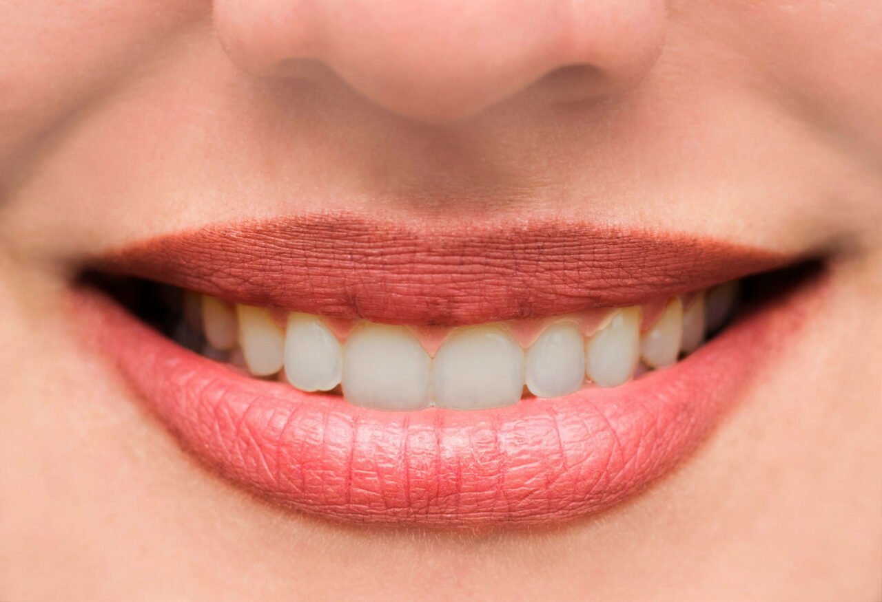 woman-s-lips-and-teeth-smile-close-up3.jpg
